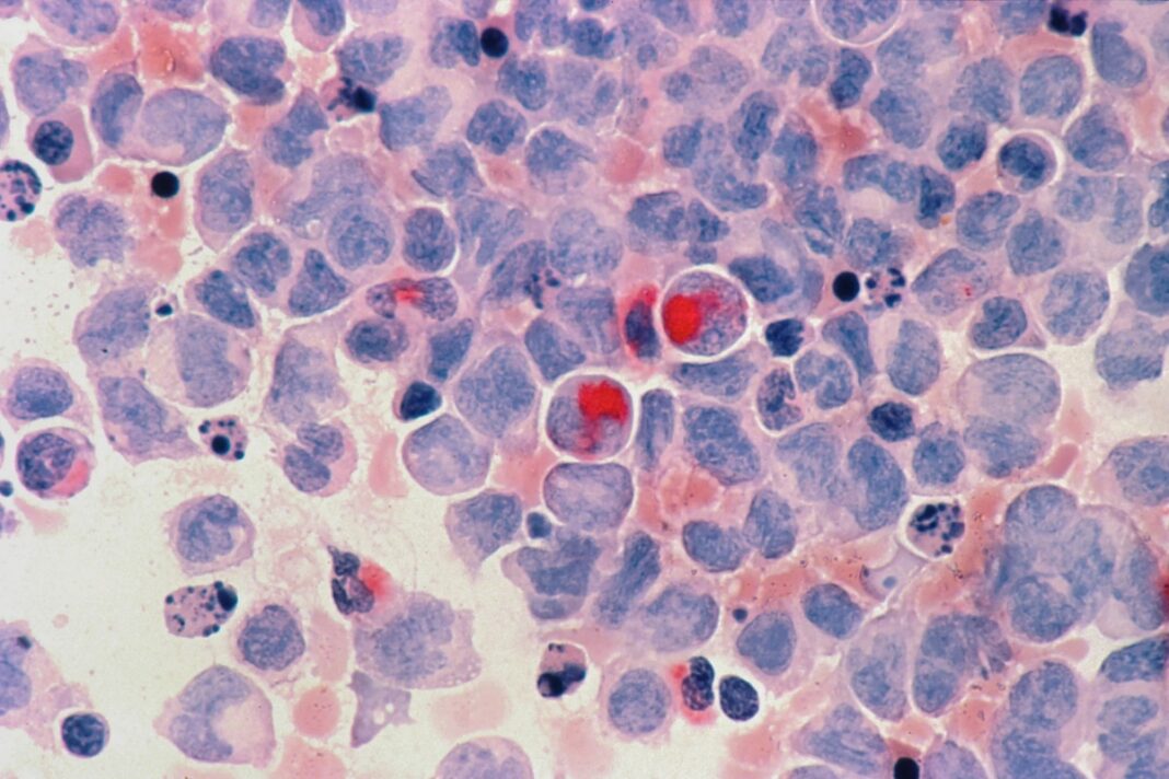 Ο-ρόλος-των-μικροοργανισμών-στην-καρκινογένεση